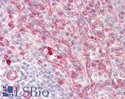 IHC-plus™ Polyclonal Rabbit anti-Human MBOAT5 / C3F Antibody (IHC)