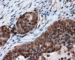 KIAA0153 / TTLL12 Antibody (clone OTI5H3)