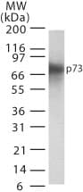 Monoclonal Mouse anti-Human TP73 / p73 Antibody (clone 5B1288, WB)