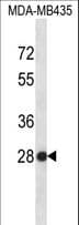 SNRPB2 Antibody (aa1-30)