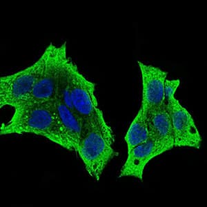 Monoclonal Mouse anti-Human CSF1R / CD115 / FMS Antibody (clone 6B9B9, aa344-497, IHC, IF, WB)