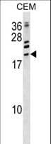 IHC-plus™ ATF3 Antibody (aa140-168)
