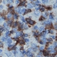 IL16 Antibody (N-Terminus)