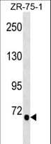 Polyclonal Rabbit anti-Human TGM5 / Transglutaminase 5 Antibody (aa686-715, WB)