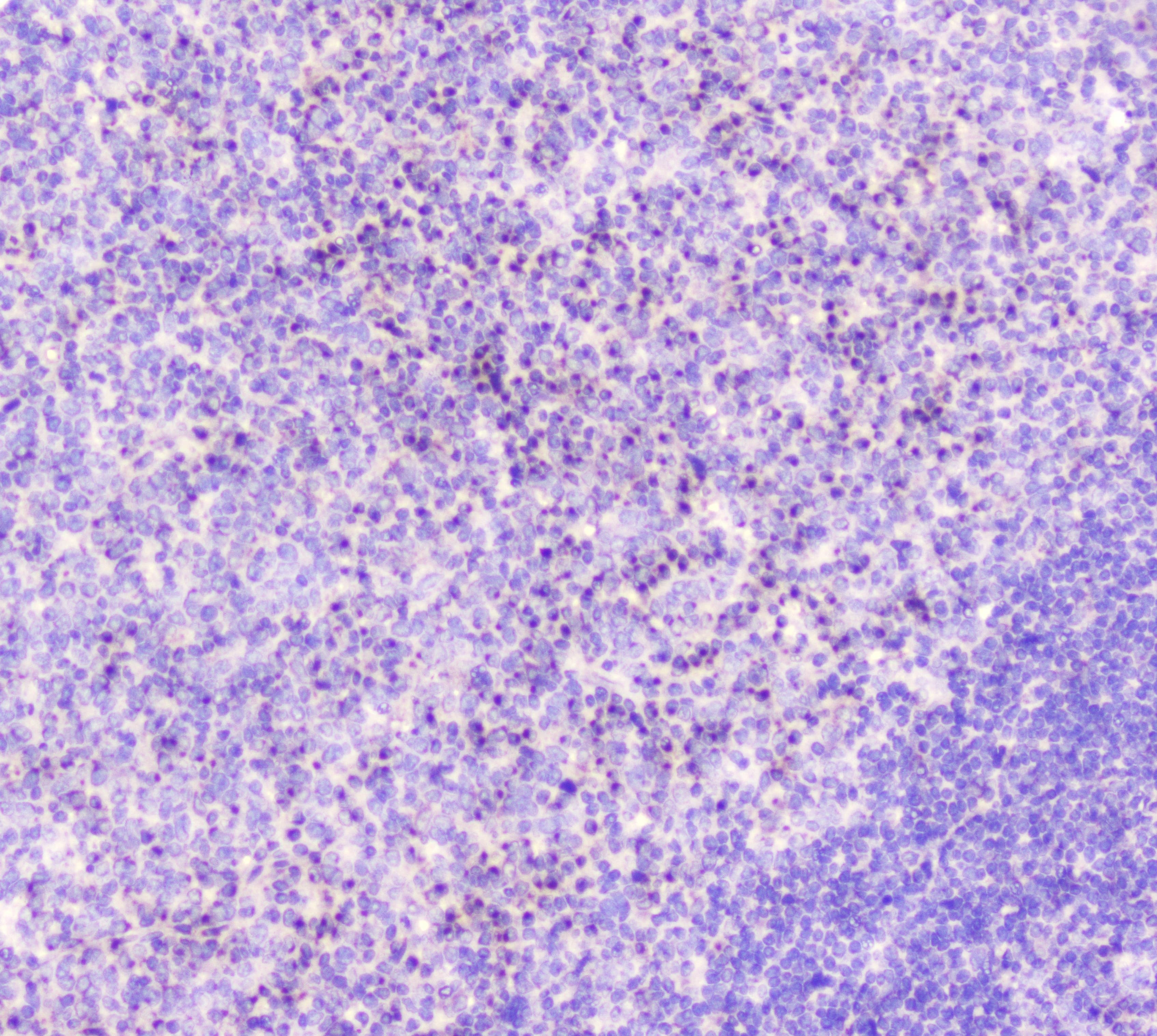 Polyclonal Rabbit anti-Human GOLGA2 / GM130 Antibody (IHC, WB)