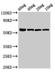 Polyclonal Rabbit anti-Porphyromonas gingivalis kgp Antibody (WB)