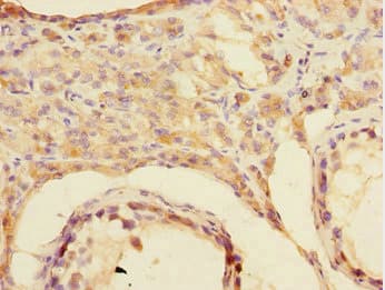 Polyclonal Rabbit anti-Human CSRNP2 / FAM130A1 Antibody (IHC, WB)