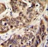 STK32A Antibody (aa1-30)