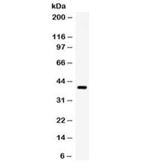 Polyclonal Rabbit anti-Human TRIB2 Antibody (IHC, WB)