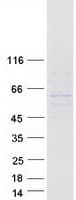 Human ANKDD1A Protein (Recombinant Myc-DDK (Flag))