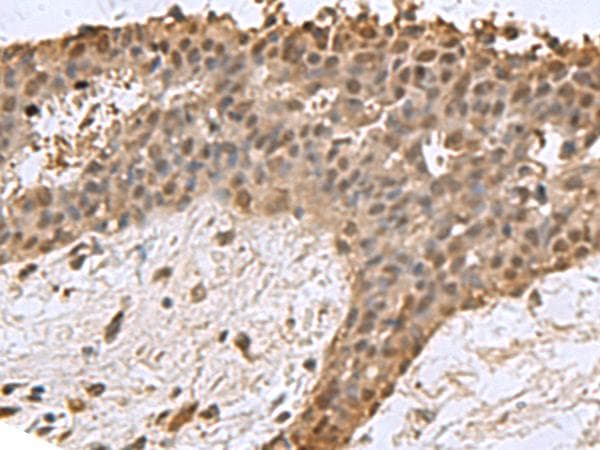 DCTPP1 / XTP3TPA Antibody