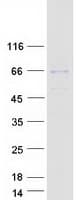 Human TBX5 Protein (Recombinant Myc-DDK (Flag))