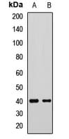 Polyclonal Rabbit anti-Human GNAI2 Antibody (IHC, WB)