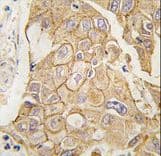 ADCY2 / Adenylate Cyclase 2 Antibody (aa940-969)