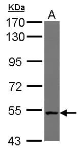 NUDCD1 Antibody