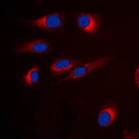 GPCRW / GPR18 Antibody (Internal)