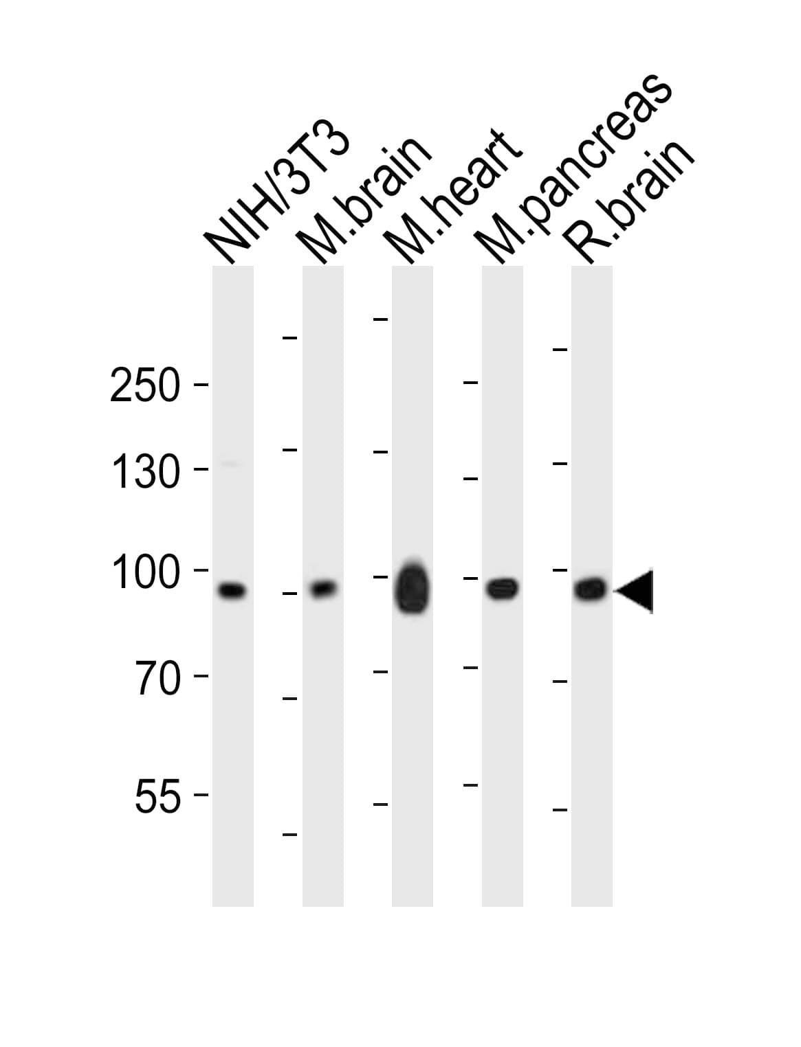 EPHB1 / EPH Receptor B1 Antibody (aa304-339)