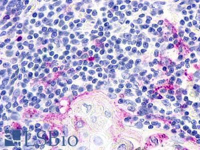 PathPlus™ Polyclonal Rabbit anti-Human CHEMR23 / CMKLR1 Antibody (N-Terminus, IHC)