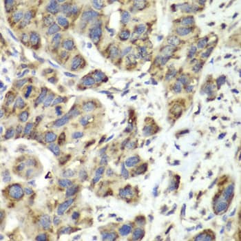 Polyclonal Rabbit anti-Human SLC25A4 / ANT Antibody (IHC, WB)