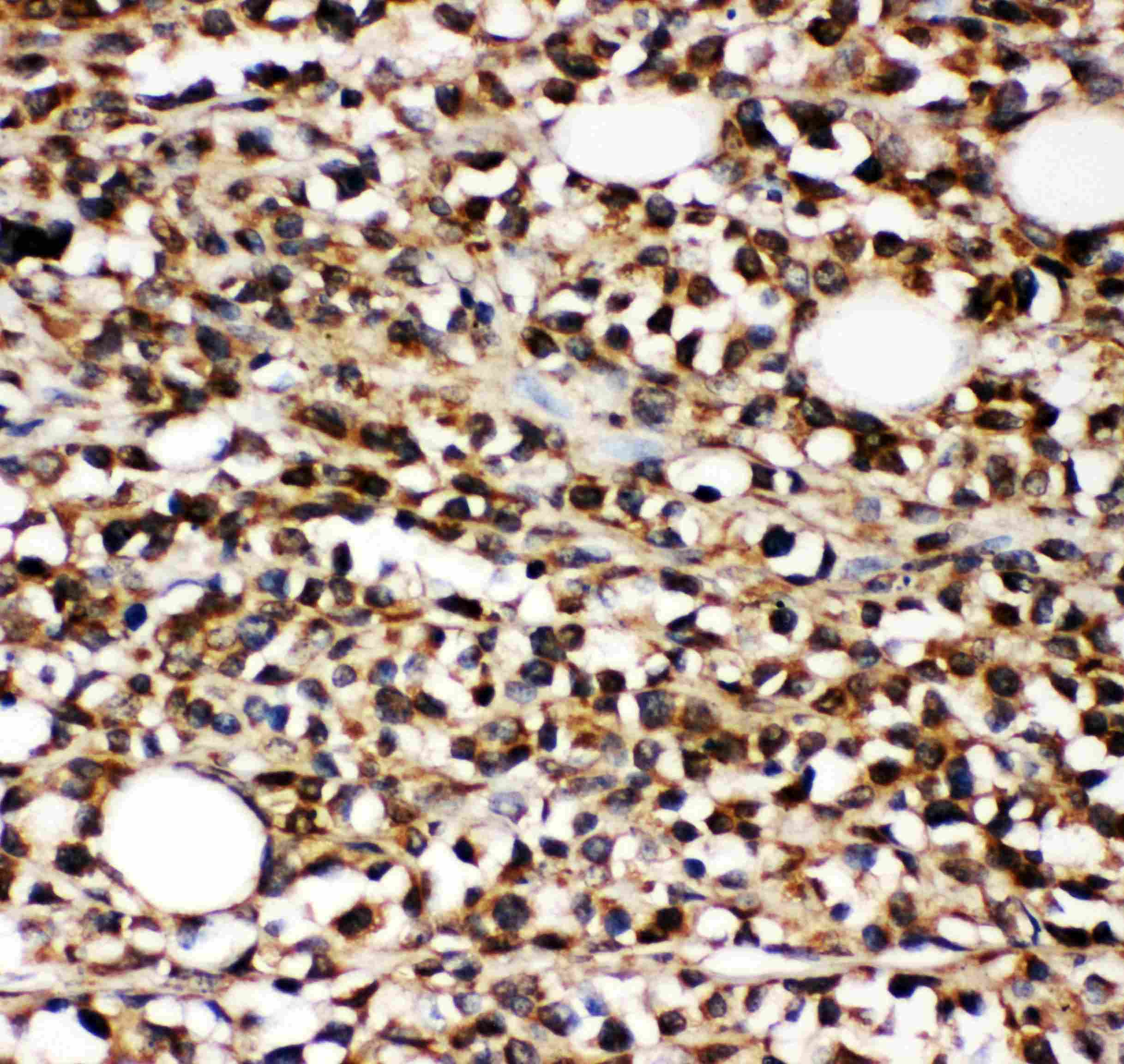 MME / CD10 Antibody (aa52-750)