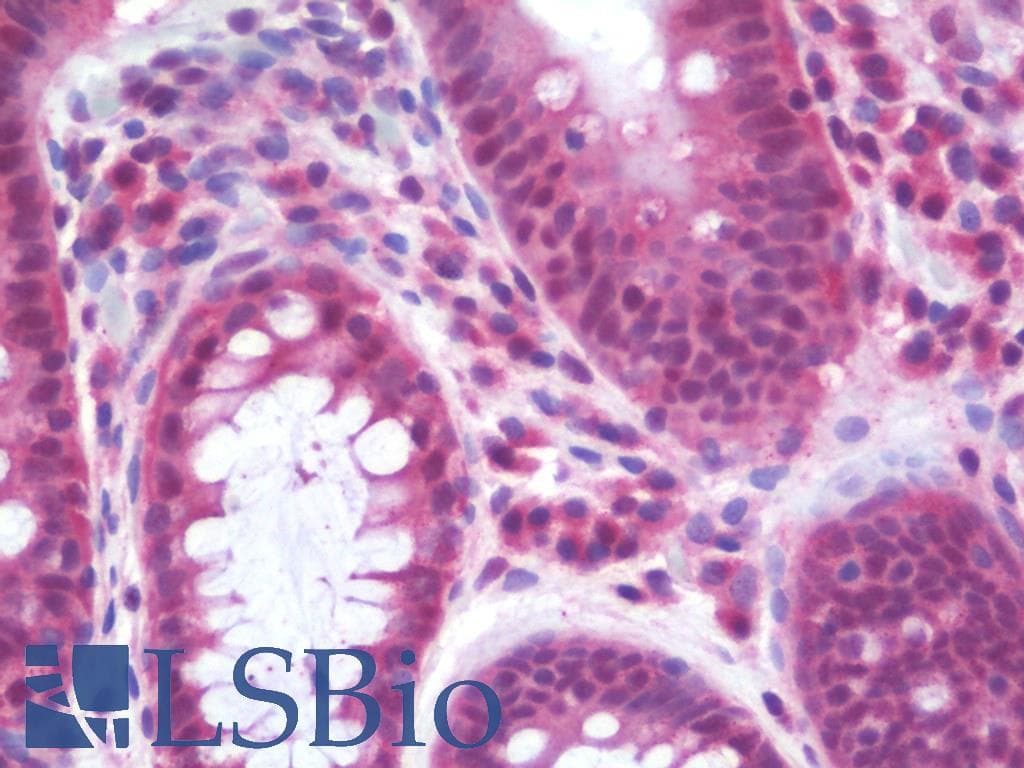 IHC-plus™ SNK / PLK2 Antibody (aa291-340)