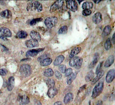 SRC Antibody (phospho-Tyr529)