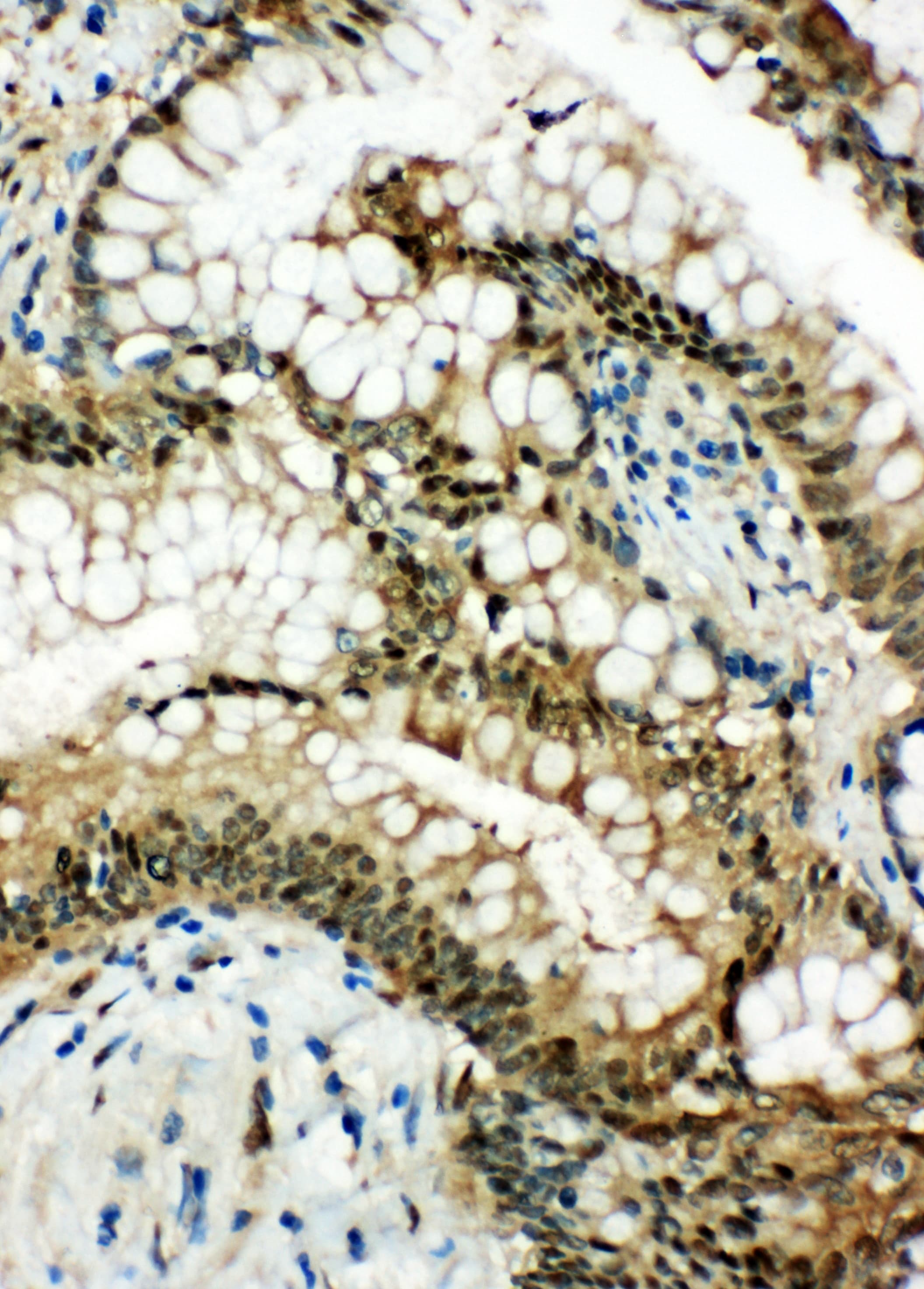 HSP70 / Heat Shock Protein 70 Antibody (aa577-596)