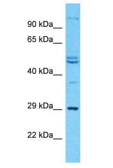 Polyclonal Rabbit anti-Human ODF3L2 Antibody (aa201-250, WB)