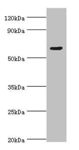Polyclonal Rabbit anti-Human TAF1B Antibody (aa369-588, IHC, WB)