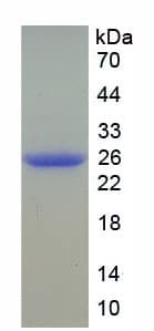 Mouse COMT Protein (Recombinant His)