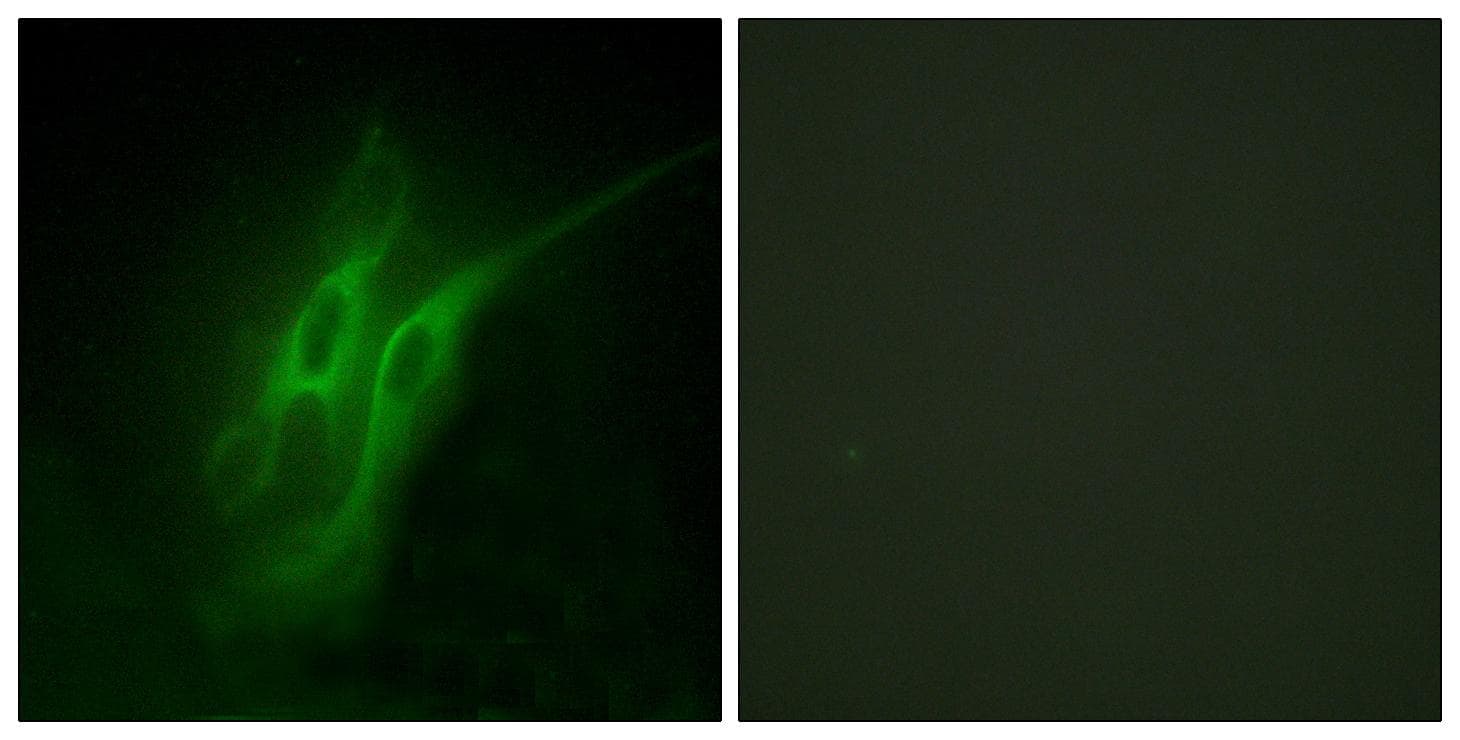 Polyclonal Rabbit anti-Human HTR4 / 5-HT4 Receptor Antibody (IF, WB)