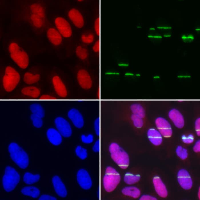 Polyclonal Rabbit anti-Human POLE3 / DNA Polymerase Epsilon Antibody (IHC, IF, WB)