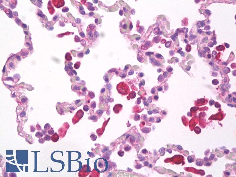 IHC-plus™ HMOX1 / HO-1 Antibody (N-Terminus)