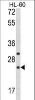 Polyclonal Rabbit anti-Human RGS1 Antibody (aa19-45, WB)