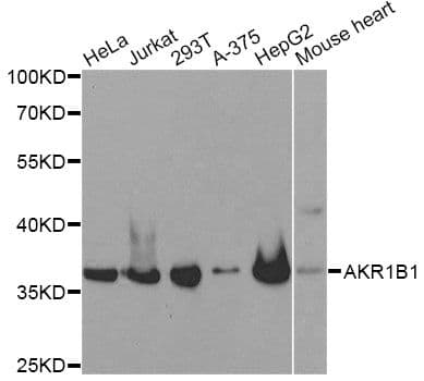 AKR1B1 / Aldose Reductase Antibody