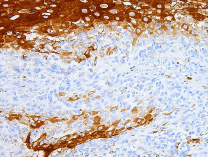 MUC6 / MUC-6 Antibody (clone AHC0179)