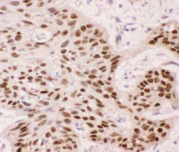 TP63 / p63 Antibody (aa311-680)