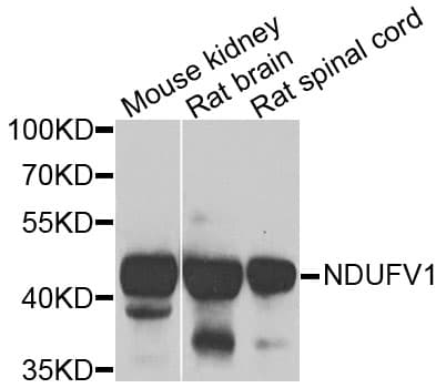 NDUFV1 Antibody