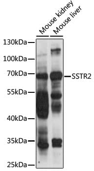 SSTR2 Antibody