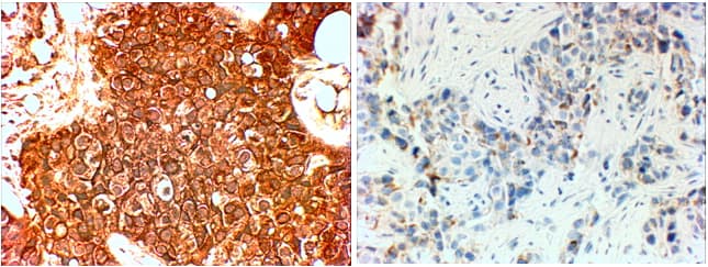 ERBB2 / HER2 Antibody (aa182-194)