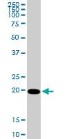 IHC-plus™ CMPK / CMPK1 Antibody (clone 1D7)