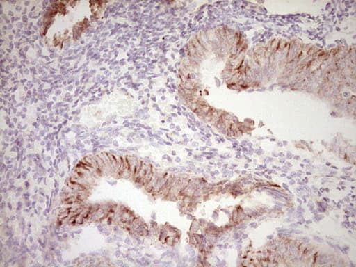 Monoclonal Mouse anti-Human Peripherin Antibody (clone OTI2D5, IHC, WB)