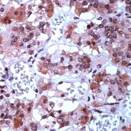 TGFA / TGF Alpha Antibody (C-Terminus)