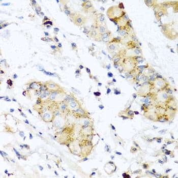IL28B Antibody