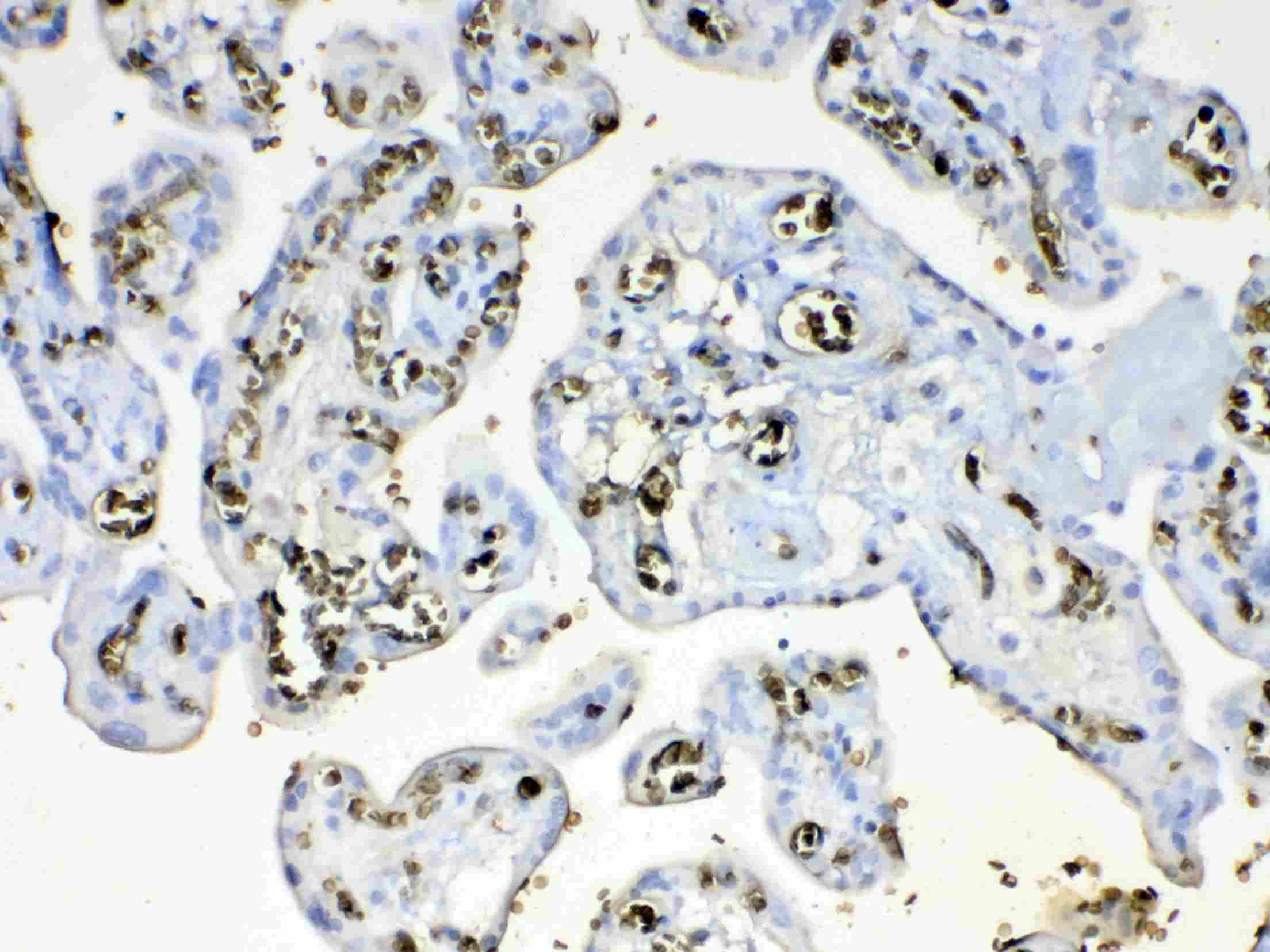 HBD / Hemoglobin Delta Antibody