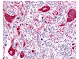 Polyclonal Rabbit anti-Human ROBO1 Antibody (aa1625-1650, IHC, IF, WB)
