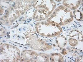 BIRC5 / Survivin Antibody (clone OTI2D9)