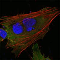IHC-plus™ MCL1 / MCL 1 Antibody (clone 8C6D4B1)