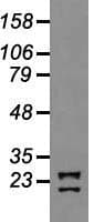 NEUROG1 / NGN1 / Neurogenin 1 Antibody (clone OTI3F9)