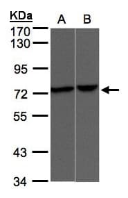 IHC-plus™ VRL1 / TRPV2 Antibody